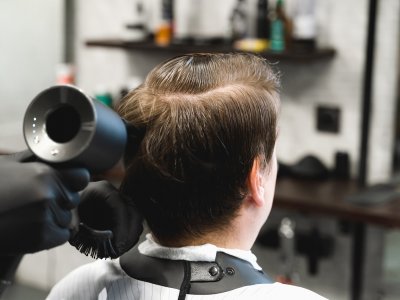 Protez Saç Uygulaması