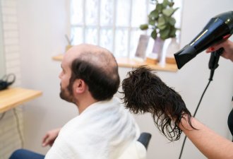 Protez Saç ile Doğal Görünüm