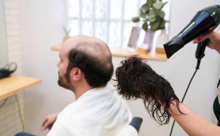 Protez Saç ile Doğal Görünüm