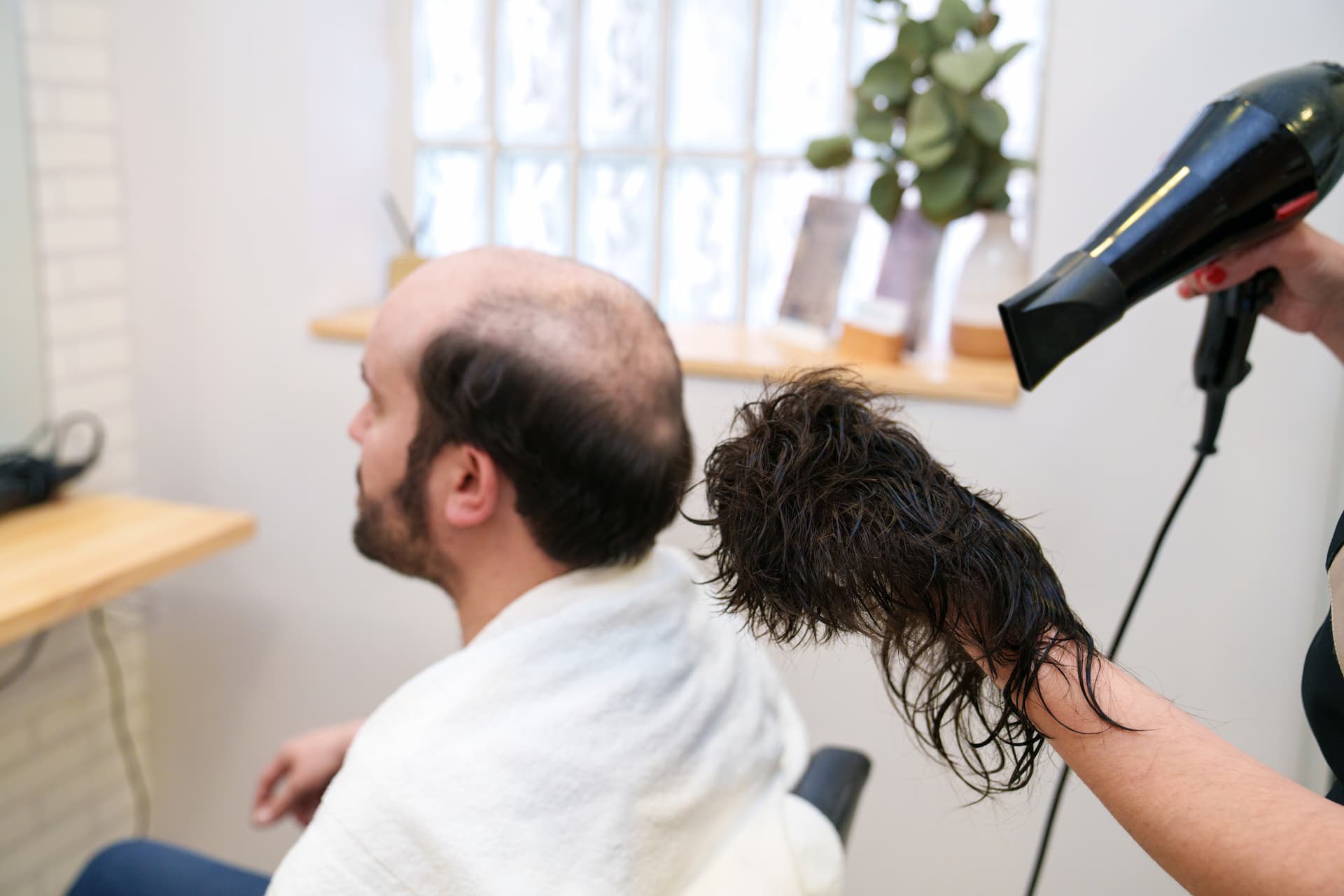 Protez Saç ile Doğal Görünüm